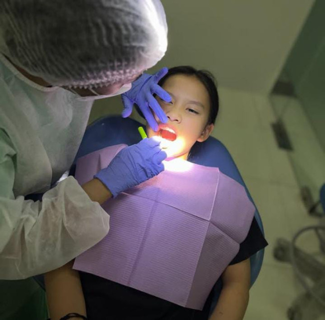 Cerita Haru Sang istri Meninggal Karena Abses Gigi, Begini Penjelasan Halodoc